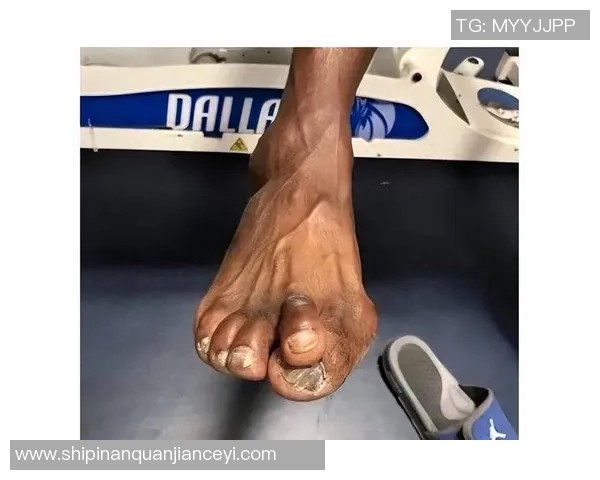 足球明星穿破鞋的真实瞬间展现运动员不屈精神与拼搏毅力 足球明星穿破鞋的真实瞬间展现运动员不屈精神与拼搏毅力